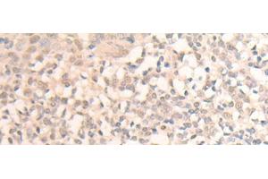 Immunohistochemistry of paraffin-embedded Human tonsil tissue using MLLT6 Polyclonal Antibody at dilution of 1:40(x200) (MLLT6 Antikörper)