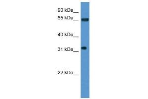 Western Blot showing SRRM4 antibody used at a concentration of 1-2 ug/ml to detect its target protein. (SRRM4 Antikörper  (Middle Region))