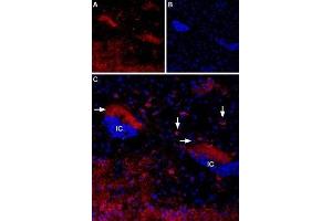 Expression of Muscarinic acetylcholine receptor M4 in mouse islands of Calleja - Immunohistochemical staining of mouse islands of Calleja (ventral striatum) using Anti-CHRM4 Antibody (ABIN7043064, ABIN7044584 and ABIN7044585). (CHRM4 Antikörper  (AA 330-340))