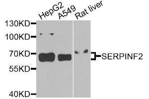 Western blot analysis of extracts of various cell lines, using SERPINF2 antibody (ABIN6003653) at 1/1000 dilution. (alpha 2 Antiplasmin Antikörper)