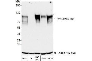 Western Blotting (WB) image for anti-Nectin-1 (NECTIN1) (AA 225-275) antibody (ABIN7795685) (Rekombinanter Nectin-1 (NECTIN1) (AA 225-275) Antikörper)