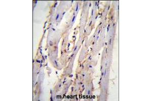 STX19 Antibody immunohistochemistry analysis in formalin fixed and paraffin embedded m. (Syntaxin 19 Antikörper  (C-Term))