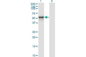 Western Blot analysis of ITFG2 expression in transfected 293T cell line by MDS028 monoclonal antibody (M01A), clone 1A8. (ITFG2 Antikörper  (AA 1-447))
