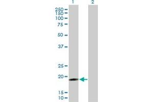 Western Blot analysis of IFNA17 expression in transfected 293T cell line by IFNA17 MaxPab polyclonal antibody. (IFNA17 Antikörper  (AA 1-189))