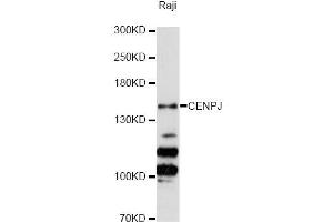 Western blot analysis of extracts of Raji cells, using CENPJ Antibody (ABIN5996394) at 1:3000 dilution. (CENPJ Antikörper)