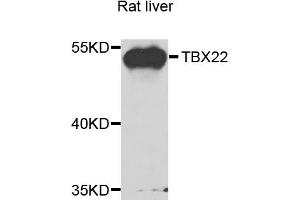 Western blot analysis of extracts of rat liver, using TBX22 antibody (ABIN5975188) at 1/1000 dilution. (T-Box 22 Antikörper)