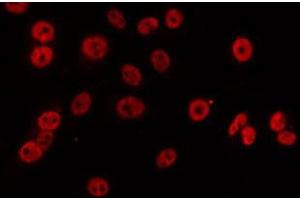ABIN6274840 staining LOVO by IF/ICC. (APBB2 Antikörper  (Internal Region))