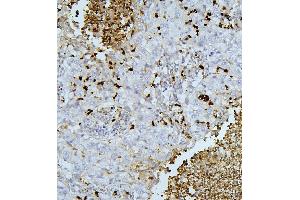 IHC analysis of PEF1 using anti-PEF1 antibody (ABIN6719632).