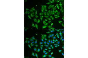 Immunofluorescence analysis of HeLa cells using CLEC3B antibody (ABIN5973819). (CLEC3B Antikörper)