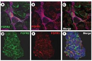 FGFR2/isolectinB4 (A) and FGFR1/isolectinB4 (B) staining of apparent mesenchymal cells and the subpopulation of endothelial cells. (FGFR2 Antikörper  (AA 22-51))