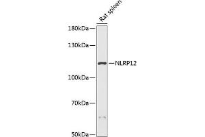 Western blot analysis of extracts of rat spleen, using NLRP12 antibody (ABIN7268937) at 1:3000 dilution. (NLRP12 Antikörper  (AA 862-1062))
