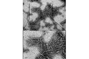 TEM of A53T alpha synuclein Pre-formed Fibrils (ABIN6952303, ABIN6952304 and ABIN6952305)