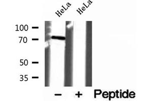 Western blot analysis of extracts of HeLa cells, using VPS33B antibody. (VPS33B Antikörper)