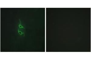 Immunofluorescence analysis of HepG2 cells, using MRC2 Antibody.