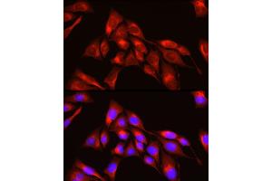 Immunofluorescence analysis of U2OS cells using TRIM4 Rabbit pAb (ABIN7270999) at dilution of 1:250 (40x lens). (TRIM4 Antikörper  (AA 1-280))