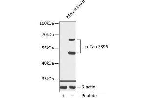 Western blot analysis of extracts from Mouse brain tissue using Phospho-Tau(S396) Polyclonal Antibody. (tau Antikörper  (pSer396))