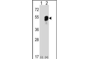 Western blot analysis of RS2 (arrow) using rabbit polyclonal RS2 Antibody (C-term) (ABIN6242575 and ABIN6577319). (PARS2 Antikörper  (C-Term))