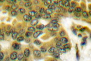 Image no. 1 for anti-Prostate Specific Antigen (PSA) antibody (ABIN271793) (Prostate Specific Antigen Antikörper)