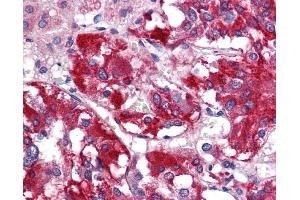 Immunohistochemistry (IHC) image for anti-Glutamate Decarboxylase 1 (Brain, 67kDa) (GAD1) (N-Term) antibody (ABIN2785667) (GAD Antikörper  (N-Term))