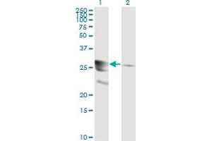 Western Blotting (WB) image for anti-GTP Cyclohydrolase 1 (GCH1) (AA 84-173) antibody (ABIN598708) (GCH1 Antikörper  (AA 84-173))