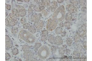 Immunoperoxidase of monoclonal antibody to SLC4A8 on formalin-fixed paraffin-embedded human salivary gland.