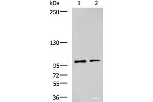 Western blot analysis of Raji and HepG2 cell lysates using GLI1 Polyclonal Antibody at dilution of 1:900 (GLI1 Antikörper)