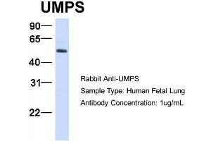 Host:  Rabbit  Target Name:  UMPS  Sample Type:  Human Fetal Lung  Antibody Dilution:  1. (UMPS Antikörper  (C-Term))