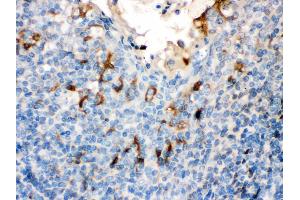 Filaggrin was detected in paraffin-embedded sections of human Tonsil tissues using rabbit anti- Filaggrin Antigen Affinity purified polyclonal antibody at 1 μg/mL. (Filaggrin Antikörper  (AA 1-261))
