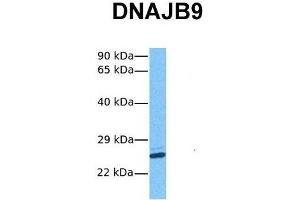 Host:  Rabbit  Target Name:  DNAJB9  Sample Tissue:  Human Hela  Antibody Dilution:  1. (DNAJB9 Antikörper  (N-Term))