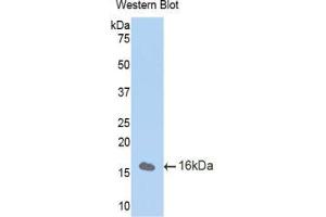 Western blot analysis of the recombinant protein. (CUBN Antikörper  (AA 3157-3274))