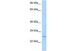 WB Suggested Anti-Tm2d3 Antibody Titration: 1. (TM2D3 Antikörper  (C-Term))