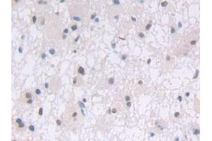 Immunohistochemistry (IHC) image for anti-phospholipase C, gamma 1 (PLCG1) (AA 1091-1290) antibody (ABIN7431485)