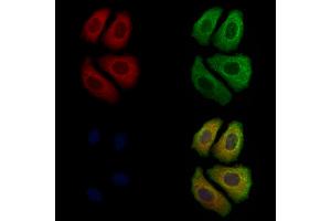 ABIN7094072 and ABIN7098116 staining Hela cells by IF/ICC. (ARHGAP15 Antikörper  (N-Term))