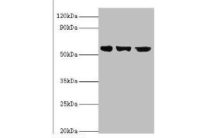 Western blot All lanes: Bardet-Biedl syndrome 4 protein antibody at 4 μg/mL Lane 1: Hela whole cell lysate Lane 2: U251 whole cell lysate Lane 2: Mouse heart tissue Secondary Goat polyclonal to rabbit IgG at 1/10000 dilution Predicted band size: 59, 60, 39 kDa Observed band size: 59 kDa (BBS4 Antikörper  (AA 350-519))