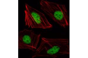 Fluorescent image of HUVEC cell stained with TBX15 Antibody (N-term) (ABIN1539402 and ABIN2849989).