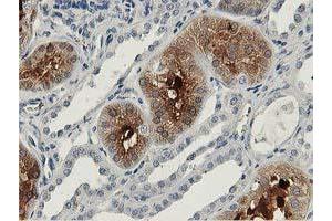 Immunohistochemical staining of paraffin-embedded Human Kidney tissue using anti-ALDOB mouse monoclonal antibody. (ALDOB Antikörper)