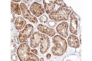 ABIN6266616 at 1/100 staining human kidney tissue sections by IHC-P.