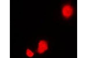 Immunofluorescent analysis of STIP1 staining in Hela cells. (STIP1 Antikörper)