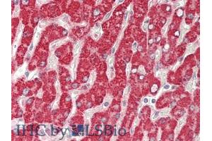 IHC-P analysis of Human Liver Tissue, with HE staining. (GBA Antikörper  (AA 117-214))