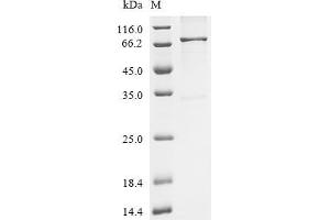 (Tris-Glycine gel) Discontinuous SDS-PAGE (reduced) with 5 % enrichment gel and 15 % separation gel.