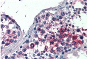 Human Testis (formalin-fixed, paraffin-embedded) stained with FHL1 antibody ABIN337221 at 2. (FHL1 Antikörper  (AA 261-272))