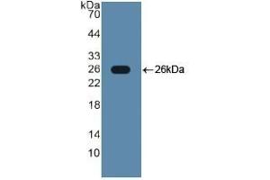 Detection of Recombinant TLR2, Human using Polyclonal Antibody to Toll Like Receptor 2 (TLR2) (TLR2 Antikörper  (AA 644-784))