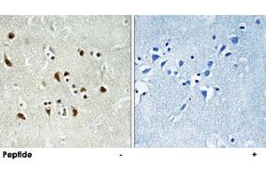 Immunohistochemistry analysis of paraffin-embedded human brain tissue using TUBGCP6 polyclonal antibody . (GCP6 Antikörper)
