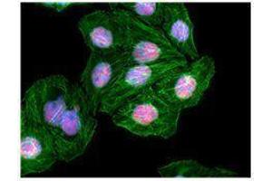 anti-Th-POK antibody