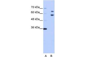 WB Suggested Anti-TROVE2 Antibody Titration:  0.