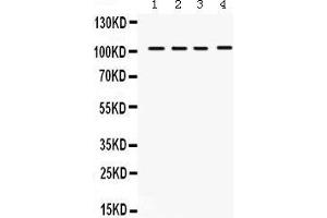 Western Blotting (WB) image for anti-Histone Deacetylase 7 (HDAC7) (AA 68-103), (N-Term) antibody (ABIN3042441) (HDAC7 Antikörper  (N-Term))