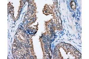 Immunohistochemical staining of paraffin-embedded Kidney tissue using anti-BTK mouse monoclonal antibody. (BTK Antikörper)