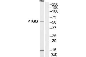 Western Blotting (WB) image for anti-Prostaglandin I2 (Prostacyclin) Synthase (PTGIS) (Internal Region) antibody (ABIN1852636) (PTGIS Antikörper  (Internal Region))