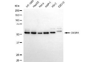 Western blotting analysis using OXSR1 antibody (ABIN7799712).