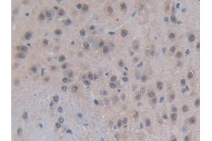 Detection of EP300 in Mouse Brain Tissue using Polyclonal Antibody to E1A Binding Protein P300 (EP300) (p300 Antikörper  (AA 2124-2397))